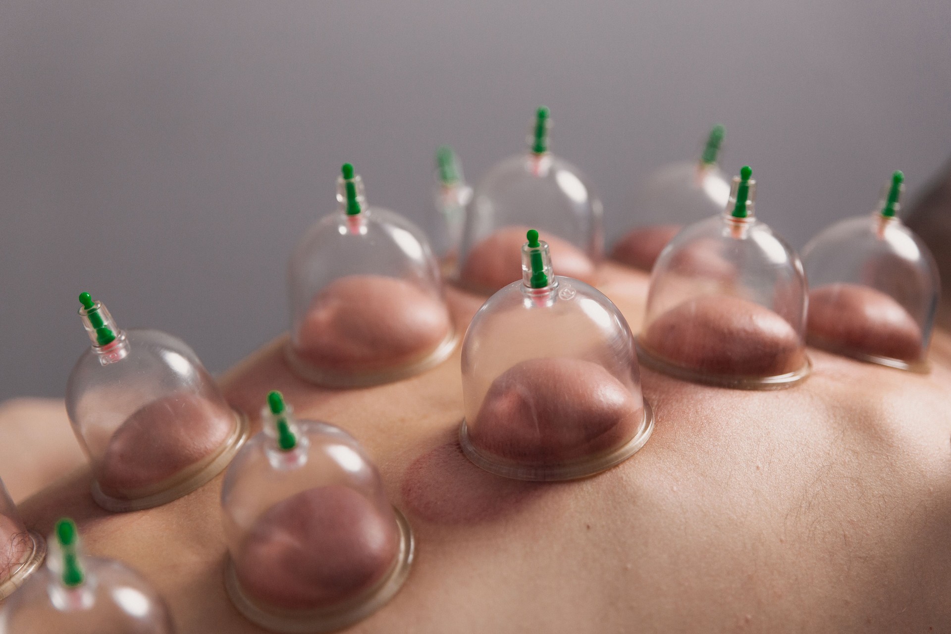Banks for massage on the man's back. Massage with vacuum cups.